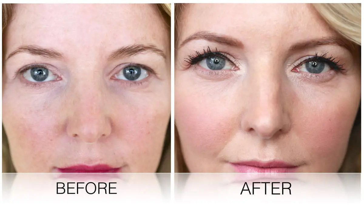My before and after pictures of microblading beauty treatment for my eyebrows
