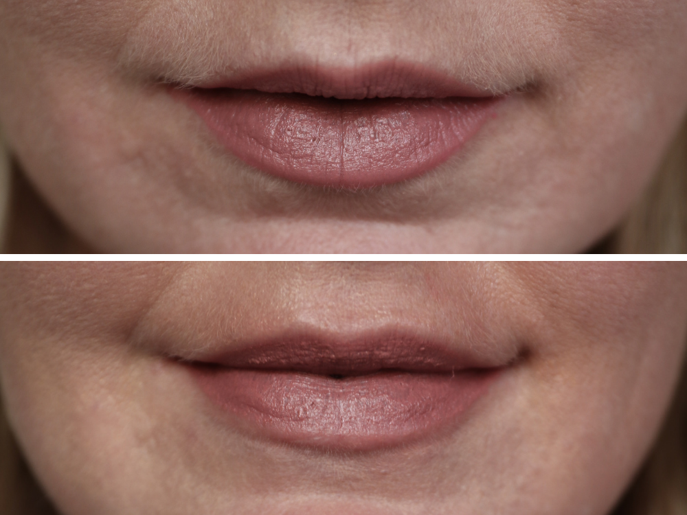 NuFace Fix before and after pictures featuring lips on beauty blogger over 40 Erin Busbee of Busbee Style