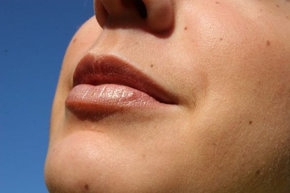 woman's face in the sun facial hair, summer skin problems