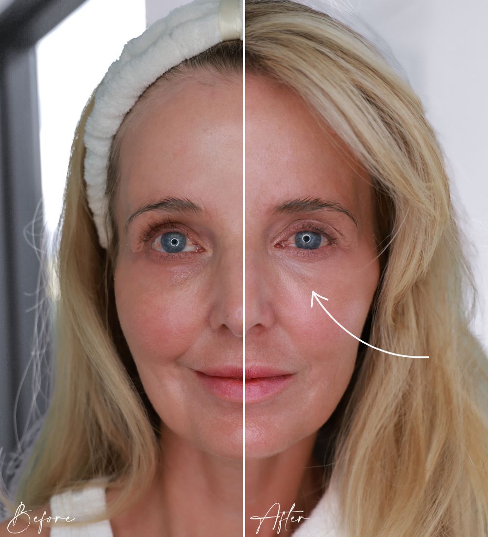 Colleen Rothschild Illuminated Tinted Eye Cream before and after